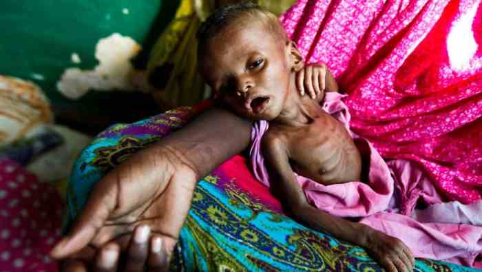 Somalie...la famine tue 11 personnes dans le «centre de Juba»