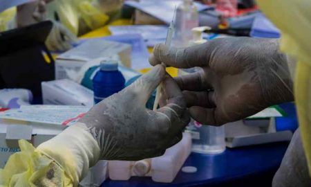 OMS : 155 personnes ont été suivies en Guinée après infection par le virus de Marburg