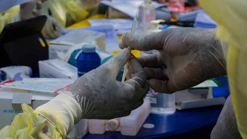 OMS : 155 personnes ont été suivies en Guinée après infection par le virus de Marburg