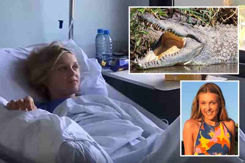 Une jeune Britannique s'échappe miraculeusement des mâchoires d'un crocodile en Zambie