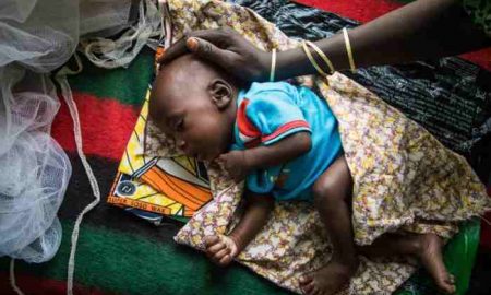 UNICEF : 1,5 million d'enfants en Afrique orientale et australe n'ont pas accès à un traitement contre l'émaciation sévère