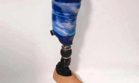 Des prothèses fabriquées au Burundi changent des vies