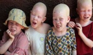 Un tribunal du Malawi condamne de trois à 155 ans de prison pour meurtre d'albinos