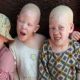 Un tribunal du Malawi condamne de trois à 155 ans de prison pour meurtre d'albinos