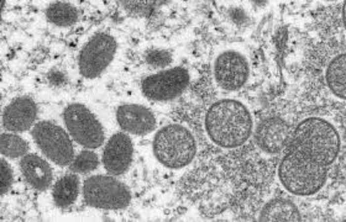 L'Afrique signale 1 597 cas suspects de monkeypox cette année, dont 66 décès