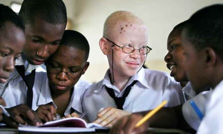 L'albinisme…Une cause de discrimination et de violation des droits de l'homme en Afrique