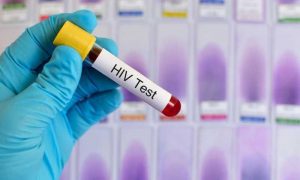 Ghana : 23 495 tests positifs pour le VIH au premier semestre 2022