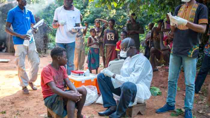 L'Inde et le Ghana signalent les deux premiers décès dus au virus de la variole du singe