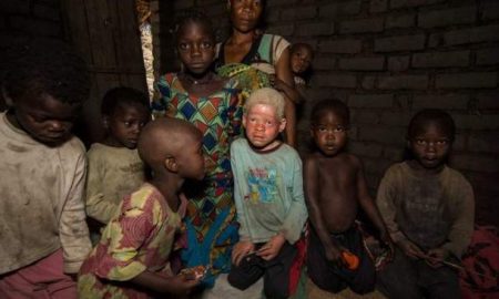 Morts et blessés à Madagascar lors d'une fusillade sur fond d'enlèvement de personnes atteintes d'albinisme