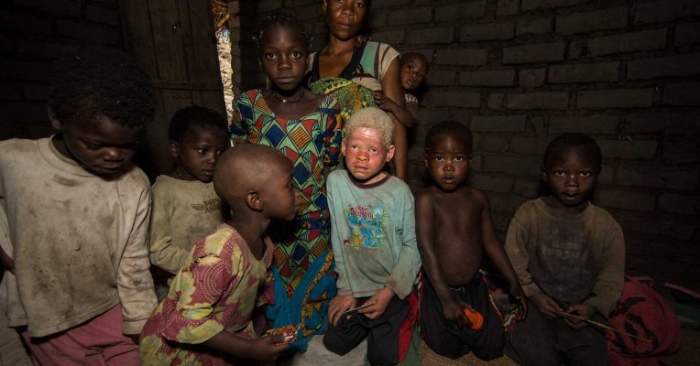 Morts et blessés à Madagascar lors d'une fusillade sur fond d'enlèvement de personnes atteintes d'albinisme