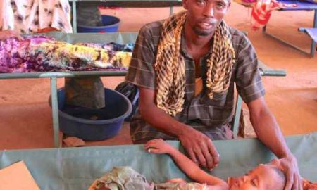 UNICEF : des centaines d'enfants sont morts dans des centres de nutrition en Somalie