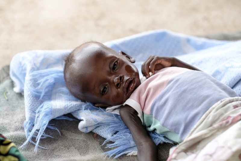 Soudan du Sud : la malnutrition touche plus d'un million d'enfants et les organisations humanitaires tirent la sonnette d'alarme