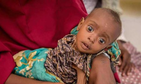 Appel de fonds de l'ONU pour sauver 30 millions d'enfants malnutris en Afrique