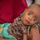 Appel de fonds de l'ONU pour sauver 30 millions d'enfants malnutris en Afrique