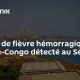 Sénégal : fièvre de Crimée-Congo détectée