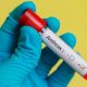 Le Nigeria confirme le premier cas d'anthrax, tout ce que vous devez savoir sur la maladie