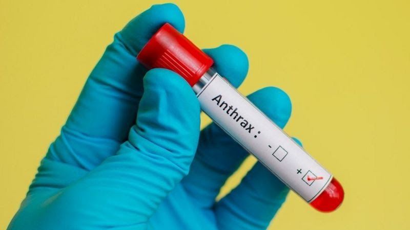 Le Nigeria confirme le premier cas d'anthrax, tout ce que vous devez savoir sur la maladie