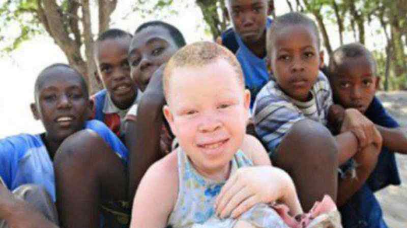Albinisme en Afrique
