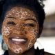Normes de beauté en Afrique...Front large pour les femmes, cheveux rasés et cicatrices faciales sont les plus beaux signes de beauté